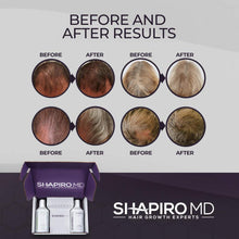 Hair Loss Shampoo and Conditioner | All-Natural DHT Blockers for Thinning Hair Developed by Dermatologists | Experience Healthier, Fuller & Thicker Looking Hair – Shapiro MD | 1-Month Supply